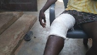 Odai Laryea still has three bullets in his thigh six weeks after the incident