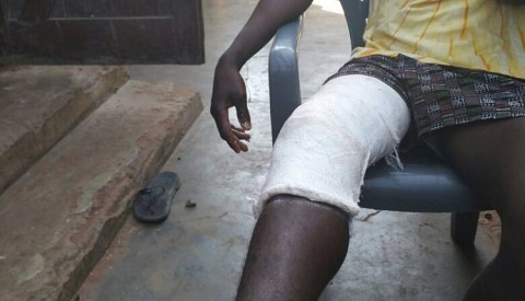 Odai Laryea still has three bullets in his thigh six weeks after the incident