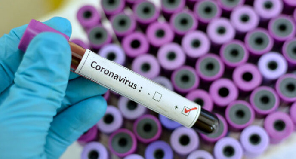 Coronavirus test - File Photo