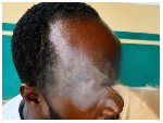 Man hospitalised after allegedly being stabbed in skull