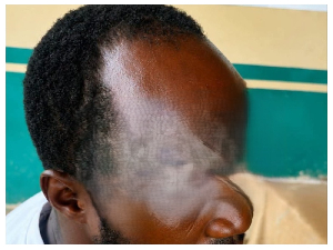 He was allegedly stabbed in the skull with a motorcycle key