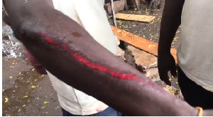 A victim of the brutality displaying his wound