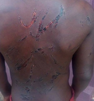 Nine year old boy beaten for allegedly stealing GH