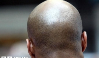 File photo of a bald black man