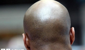 File photo of a bald black man