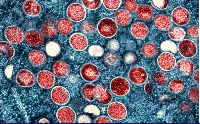 A photo depicting mpox virus