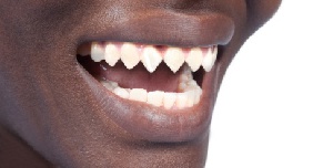 African Teeth