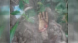 The hand of Babu Omaru was chopped off Wednesday evening by unidentified persons