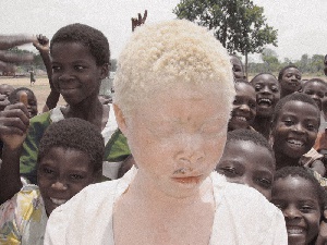 Starr Albino Boy