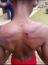A picture of Antwi with cane injuries on his back
