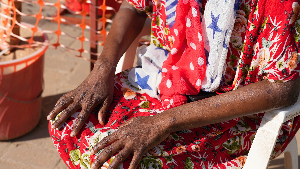 Mpox scars on a recovered patient