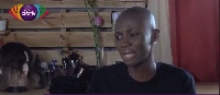 Lahadi Samira was born with a medical condition; Alopecia areata also known as spot baldness