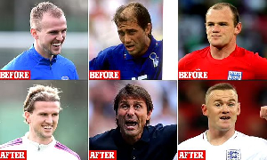A photo of football stars who transformed their look with hair transplants