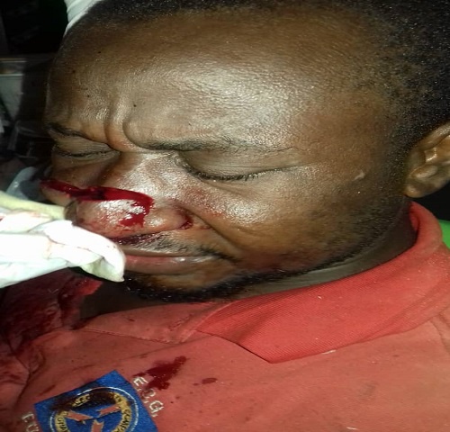 Gershon Asiedu, a PDS staff who sustained a cutlass wound on his nose