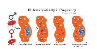 Rhesus factor incompatibility happens when an Rh-negative woman conceives an Rh-positive fetus.