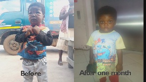 Swollen-up 3-yr-old Michael gets 15k donation to help save his kidneys after GhanaWeb story