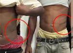 N1.5m for kidney: Lawyer alleges illegal organ harvest in Abuja N1.5m for kidney: Lawyer alleges illegal organ harvest in Abuja