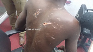 Christopher was severely beaten by the soldiers and sustained injuries to his back