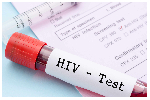 HIV Alert: Here is how to identify fake HIV test kits on the market
