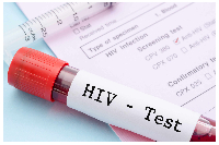 FDA warns of counterfeit HIV test kits circulating on the market