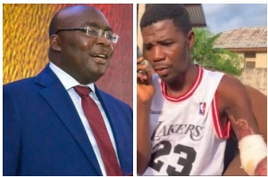 Former Vice President Dr. Bawumia [L] and the victim