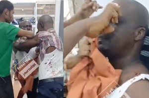 Man injured after the alleged attack by Micro Credit staff