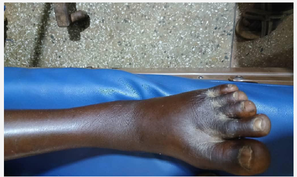 In November alone, 15 persons were bitten by snakes