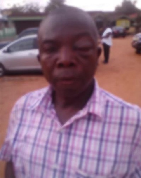 The assaulted Controller and Accountant general staff, Alexander Amegbenyo