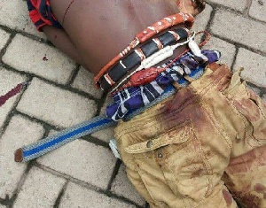 Suspect wearing a number of talismans with different colours and sizes around his waist