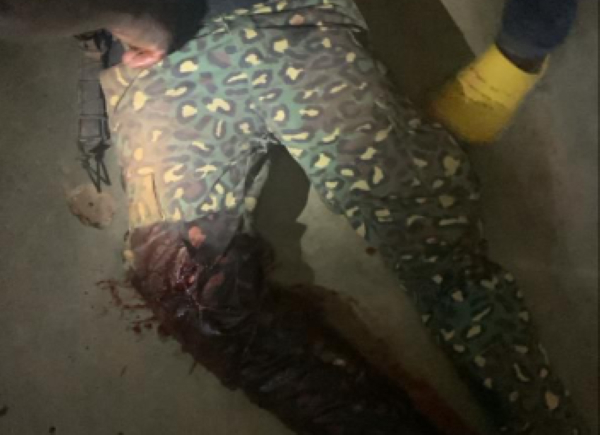 The two immigration officers were shot in the Upper East Region