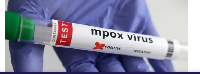 The Directorate says it has recorded one confirmed death case of Mpox in the region