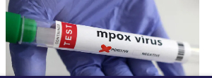 A test tube labelled 'mpox virus positive' is held in this illustration