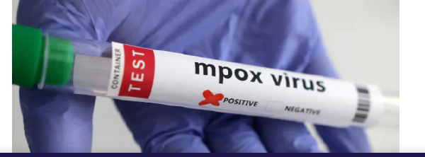 A test tube labelled 'mpox virus positive' is held in this illustration