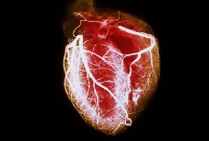 Cardio Diseases