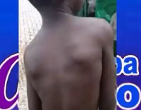 A picture of the 7-year-old boy brutally battered by his headmistress