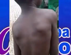 A picture of the 7-year-old boy brutally battered by his headmistress