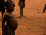 A report from Tema General Hospital shows that 11 children died from Kwashiorkor