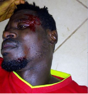 Isaac Danso Karela FC Player Attacked