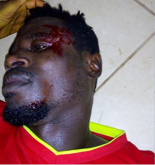 Isaac Danso sustained serious injuries from the attack