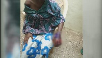 The victim is currently receiving treatment at the Walewale Government Hospital