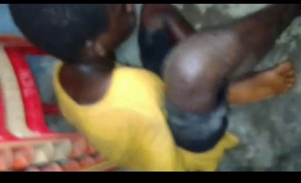 He is battling for his life at the St. Francis Xavier Hospital in Assin Fosu