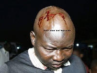 One of the victims with his head bruised