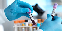 Hepatitis C elimination effort gains ground in England