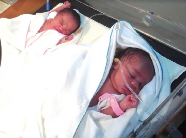 The set of twins delivered through IVF