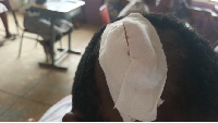A picture of injured student