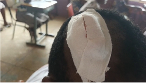Injured Student.png