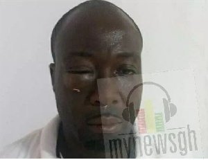 Assaulted journalist Reynold Dadzie,