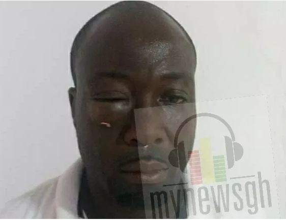 Reynold Dadzie says he was nearly burnt alive by his attackers