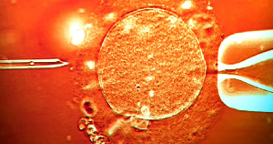 The donor's sperm was used in clinics across Europe