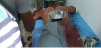 An injured person receiving treatment at the hospital